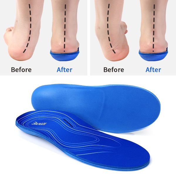 

shoe parts accessories 3angni ortic insoles for s arch support flat feet pad women men orthopedic foot care plantar fasciitis insoles 230211, White;pink