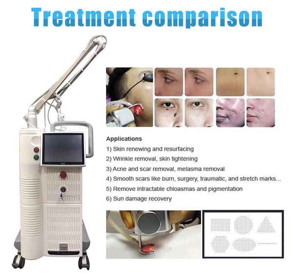 

2023 laser machine 10600nm cosmetic skin resurfacing acne scars vaginal tightening dot matrix radio frequency skin rejuvenation, Black
