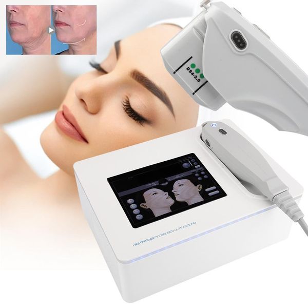 

smas hifu machine for face lifting/skin rejuvenation tightening/body slimming