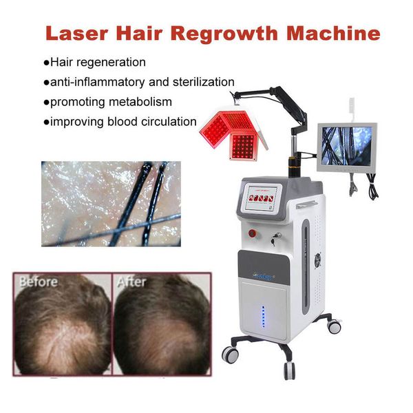 

multifunctional hair regrowth 650nm diode laser with skin analysis camera anti hair growth cold laser comb machine for hair loss treatment, Black
