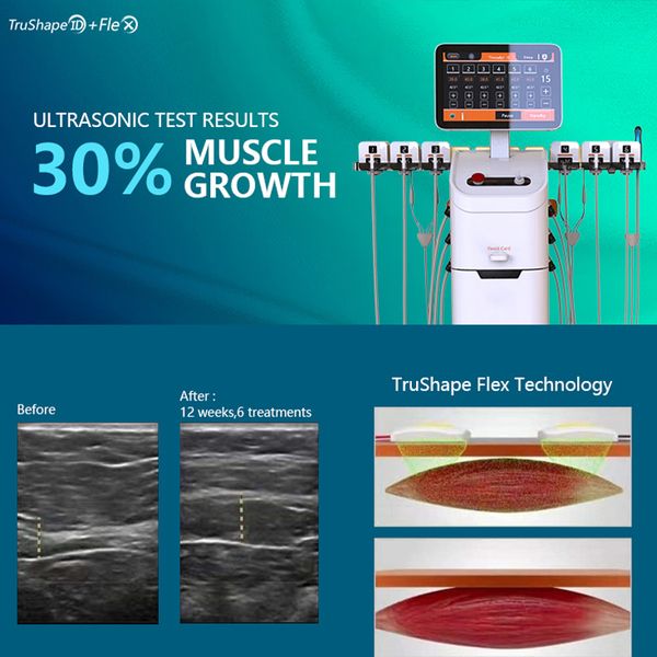 

professional fat dissolving ems slimming machine trusculpt slim body sculpting trusculpt flex rf beauty machine
