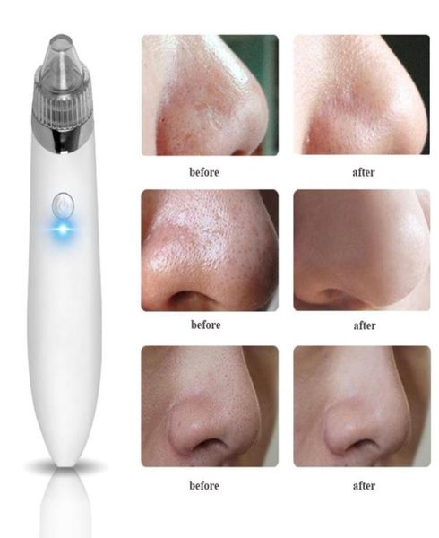 

electric usb charge vacuum blackhead removal acne blemish remover device blackhead extractor nose blackhead cleaner tool3336563