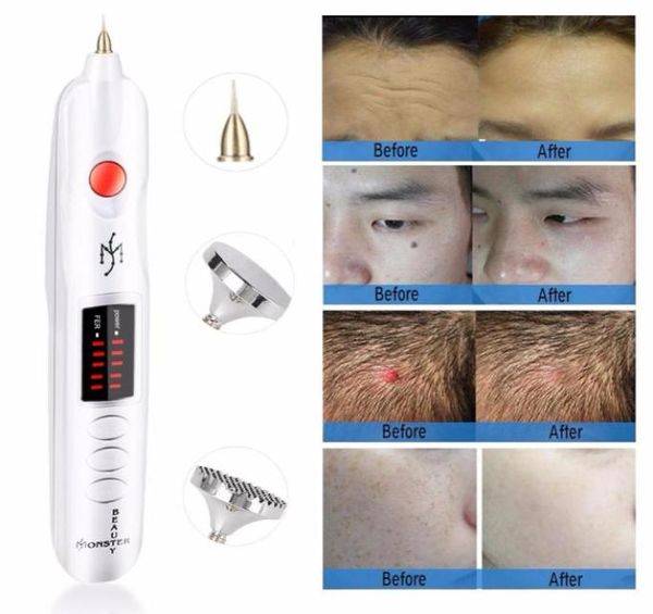 

2019 most factory korea beauty monster plasma lift pen plasma jett for spot and mole removal7606108, Black