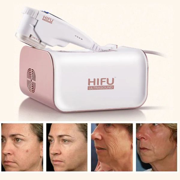 

hifu machine for face and eyes anti-aging skin lifting skin tightening hifu