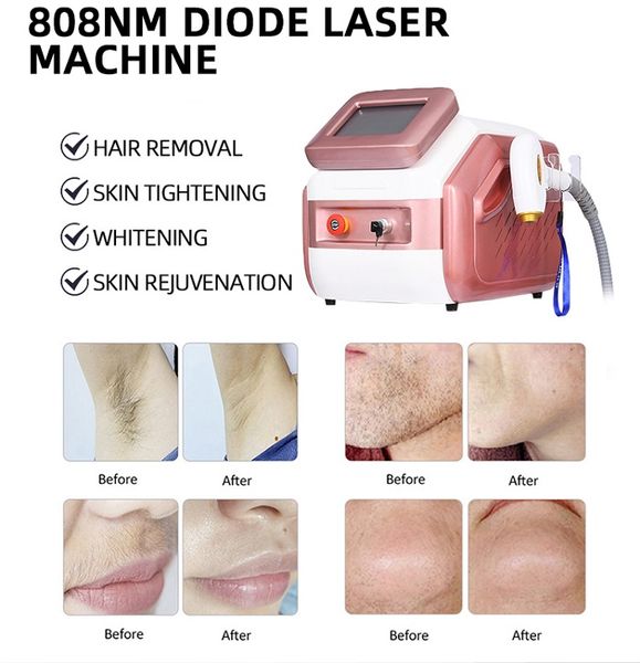 

808nm diode laser hair removal machine 3 wavelengths diod laser lazer 808nm fast all skin colors all skin type laser epilator hairs remover, Black