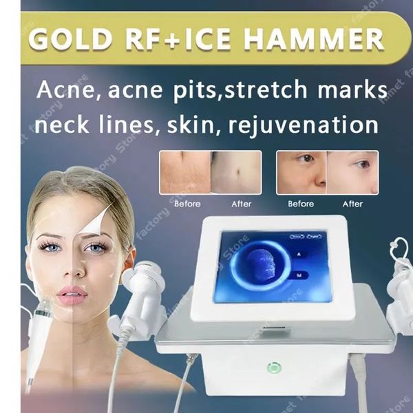 

rf fractional microneedling needle beauty machine anti-acne skin lifting -wrinkle spa equipment, Black