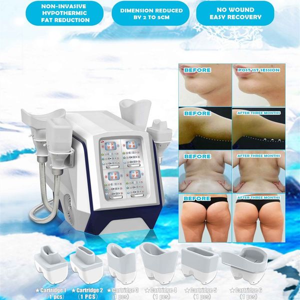 

fat er body-sculpting cryolipolisis cryotherapy system body slimming equipment cellulite frozen loss machine abdominal 4 ing handles singapo