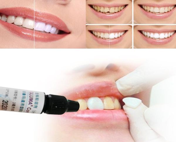 

1pc dental comfort bond tooth veneer quick adhesive desensitizer equivalent formula teeth whitening products5208883