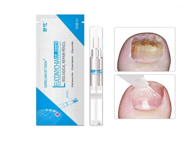 

pen nail repair fingernails toenails rich nutrition101231934698