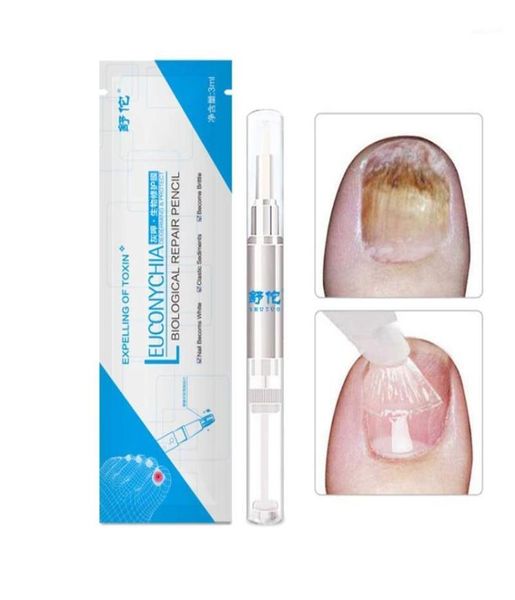 

pen nail repair fingernails toenails rich nutrition101234344935