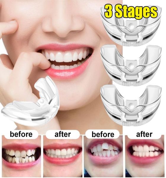 

1pc orthodontic braces appliance dental braces silicone alignment trainer teeth retainer bruxism mouth guard teeth straightener3286385, Black