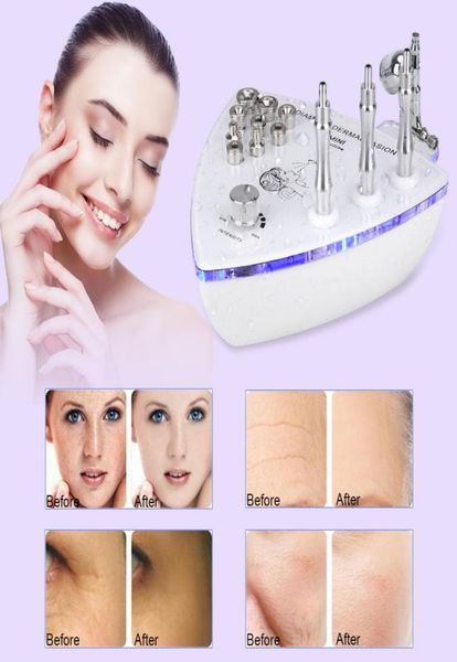 

diamond microdermabrasion dermabrasion machine with spray gun water spray vacuum suction diamond exfoliation spraying device facia2988050