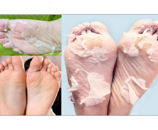 

peeling feet mask exfoliating socks baby care pedicure socks remove dead skin cuticles suso socks for pedicure3660567