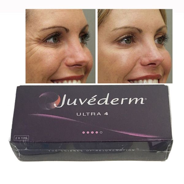 

beauty items buy juvederms 1ml ultra 3 ultra 4 dermal filler cross linked gel online