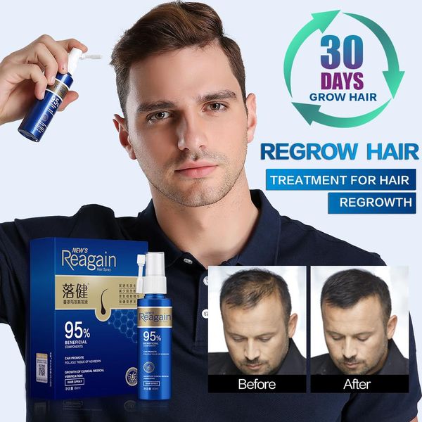 

hair loss products beauty health hair growth productshair loss product series hair rapid growth spray for men #39;s body and