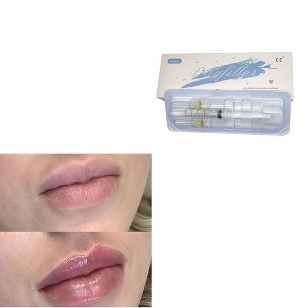 

beauty items penis enlargement breast buttock dermal filler 10ml 20ml 50ml fine derm deep ultra-deep online lips injection
