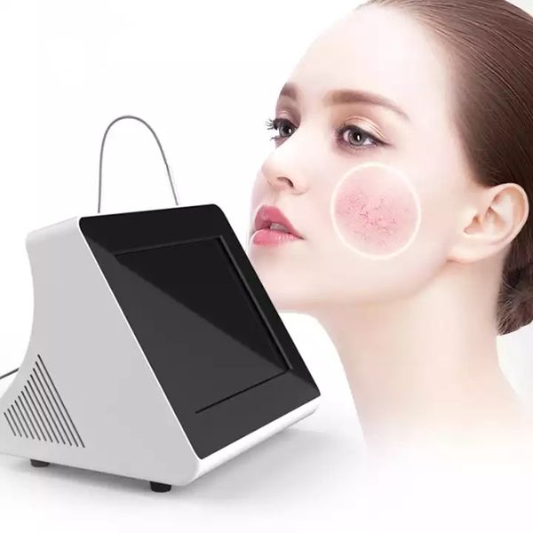 

980nm rf skin tag remover device portable spider vein beauty mole tissue red veins diode laser portable removal machine