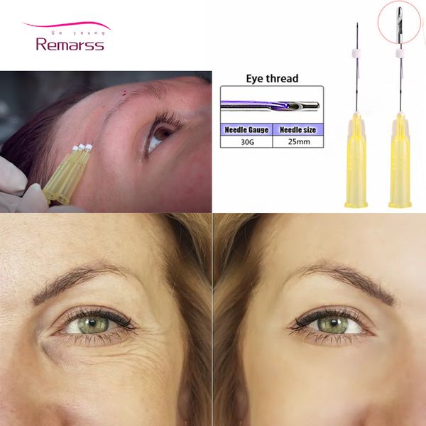 

50pieces korean pdo thread face liffting mono 26g 27g 29g 30g13mm 50mm 60mm