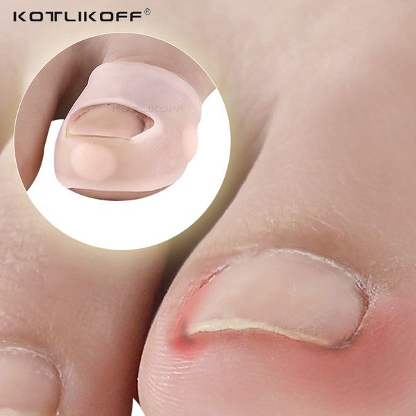 

ingrown armor elastic patch sticker straightening clip brace toenail correction insert ingrown toe nail treatment pedicure tool, Black