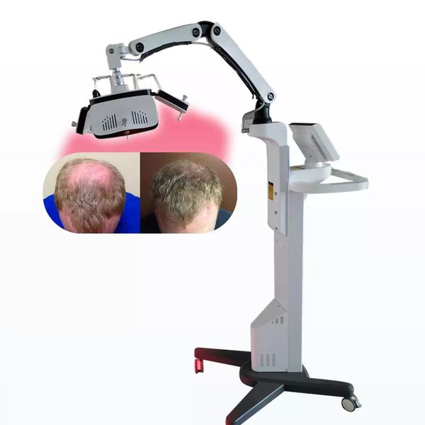 

sales 650 nm diode laser hair loss trreatment machine low level laser anti-hair removal instrument, Black