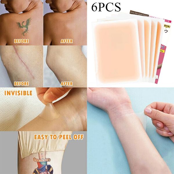 6 uds., marca de nacimiento de defectos, corrector de cicatrices impermeable, pegatina para cubrir tatuajes, Color de piel, pegatina de piel de simulación portátil