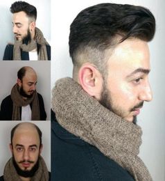 7x9 tupé de encaje para hombre sistema agansit cabello perdido peine estilo trasero reemplazo de cabello piezas superiores color natural 7928746