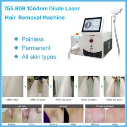 808nm diode laser ontharing machine permanent niet -pijnharen remover huid verjonging 3 golflengte 755 808 1064nm draagbare enkel handvat schoonheidscentrum machine