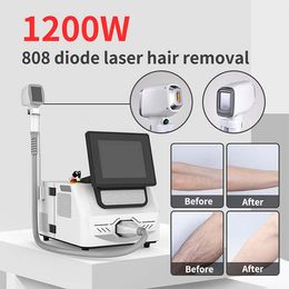 808nm diode laser ontharingssysteem gladde huid 100 miljoen handgreep shots permanent verwijderen frontale haarlijn draagbare machine