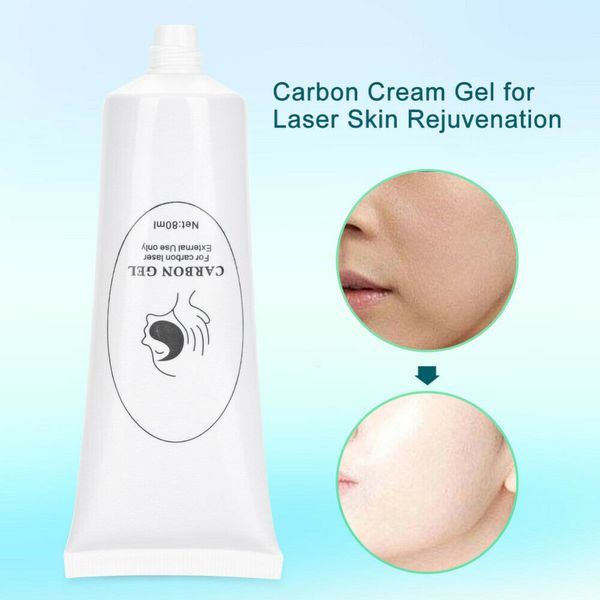 Accesorios Piezas Gel de polvo de carbono embotellado Crema de carbono de 80 ml para exfoliación facial con láser Blanqueamiento de la piel Tratamiento de rejuvenecimiento exfoliación facial limpieza profunda