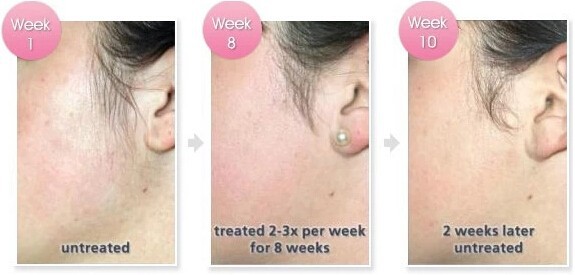 New Design No No Hair Full Body Epilator Hair Removal Pro No Pain No Need Cream From Doria7101 85 95 Dhgate Com