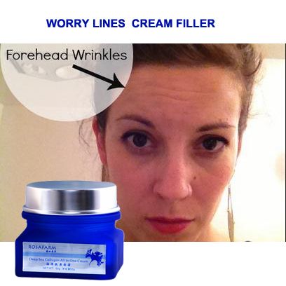 cream for wrinkles forehead