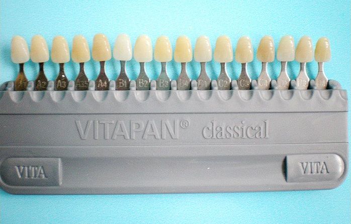 Dental Vita Acrylic Teeth Shade Guide Dental Hygienist Tools Dental ...