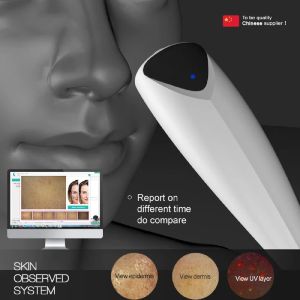 Analyseur Nouveau produit de qualité supérieure Dermatoscope vidéo numérique sans fil professionnel pour les dermatologues analyse de la peau