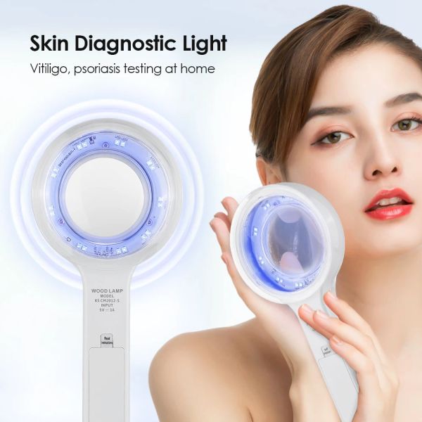 Analizador Lámpara de madera para máquina analizadora de piel Lámpara ultravioleta Examen de piel UV Prueba de belleza Análisis de aumento facial Lámpara de vitíligo