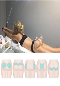 Montage de la poitrine Portable Slim Equipment Buttock Buttock Liftin Thérapie CELLULITE CUPPING MACHINE POUR GUASHA SEMPRESSAGE SUR LE RESPORT LE REFORTION 3344072