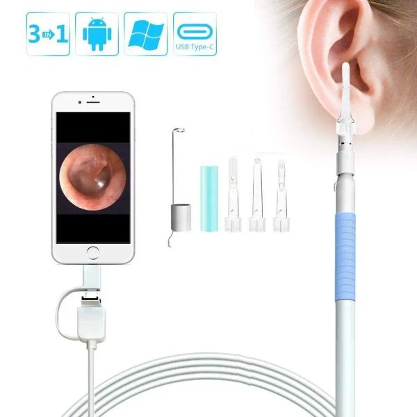 Caméras Endoscope Camera USB 1.3MP Mini Visual Ear Nettaiteur Spoon Otoscope Endoscope de nez médical pour Android PC Santé