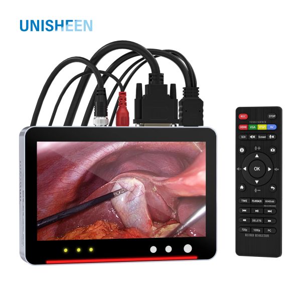 Caméras Medical Endoscope 4K Recorder pour la gynécologie et le système de caméra laparoscopique