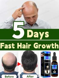 Care Hair Growth Huile, croissance rapide, réparation efficace de la calvitie, tête de cheveux complète