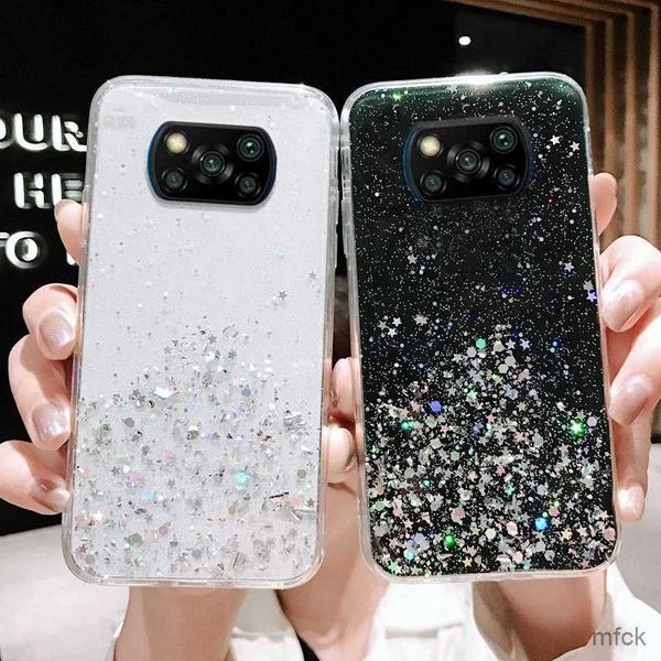 Fundas de teléfono móvil para Note 9 Pro, funda con purpurina para teléfono Note 11 10 Pro 8 7 10S 9S Mi 11 Lite Poco X3 Pro