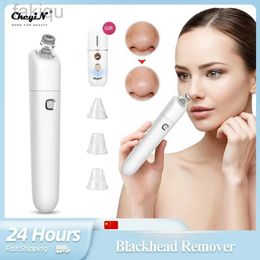 Nettoyage CKEYIN Electric Narhead Remover Avable Vacuum Facial Acné Nettoyer Pimple Pimple Trou Nettoyage Tool BlackSpot Skin Care Tool D240510