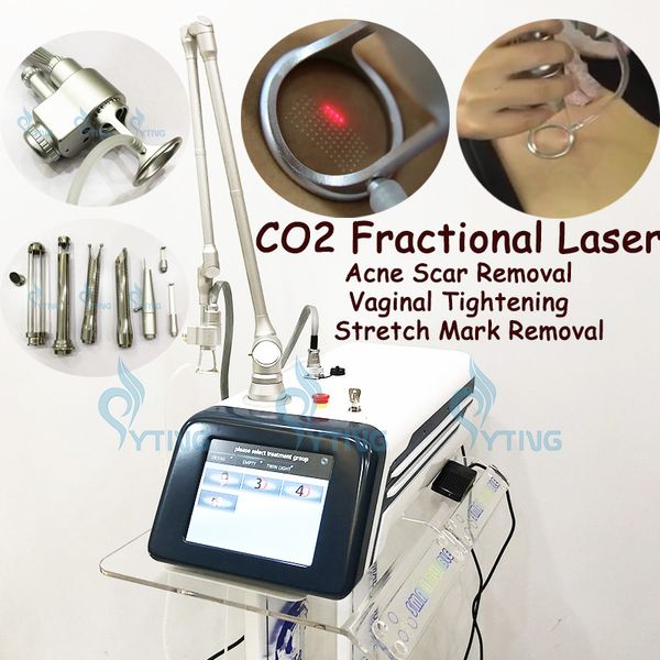 Découpeuse fractionnaire de laser de CO2 pour le retrait de tache de naissance de pigmentation de serrage de vagin