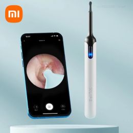 Xiaomi XLife – nettoyeur d'oreille visuel intelligent, avec caméra, dissolvant de cérumen, Endoscope HD Rechargeable, soins de nettoyage de cérumen