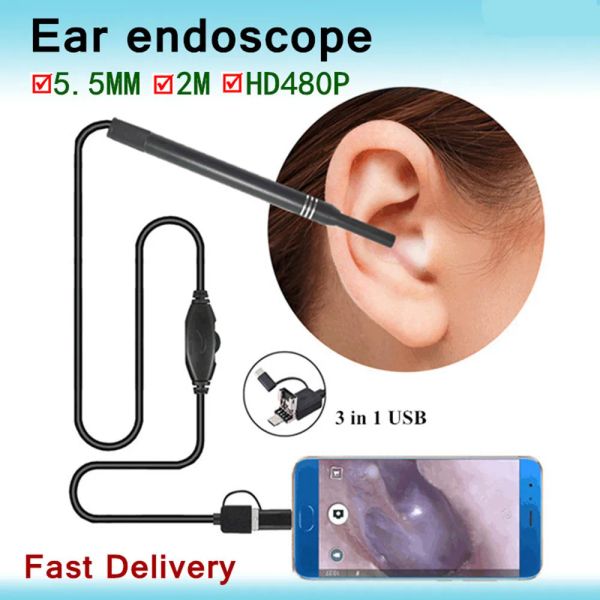 Controles Endoscop Limpiador de oídos Cámara Otoscopio transparente Limpieza médica de oídos Limpiador de eliminación de cera Dispositivo transparente para oídos Herramienta de eliminación de cera Cuidado de los oídos