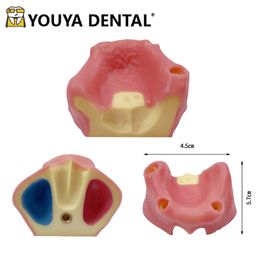 Modèle d'enseignement de l'implant dentaire Sinus maxillaire édenté avec des gommes à gommes à gommes de dents de la pratique de la pratique de la pratique de la pratique