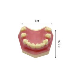 Dental Implant des dents Modèle de pratique Demo typodont pour un étudiant dentiste étudiant les modèles d'enseignement des produits de laboratoire de dentisterie