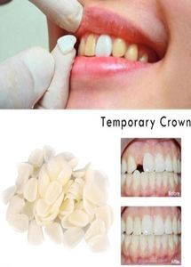 Matériaux dentaires mixtes couronne temporaire placages postérieurs