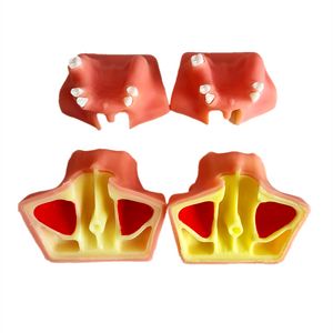 Modèle de pratique dentaire modèle maxillaire de lifting