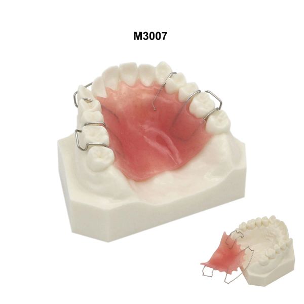 Modèle d'enseignement dentaire Modèle orthodontique de dents avec support métal / céramique Chaîne de tube Hawley Retenue pour la démo du patient dentiste