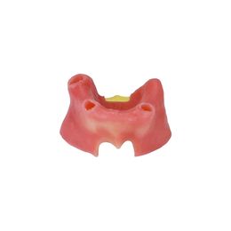 Tandheelkunde edentulante maxillaire sinus met zacht tandvlees implantaat onderwijsmodel voor tandartsstudentenpraktijk trainingstudie Model