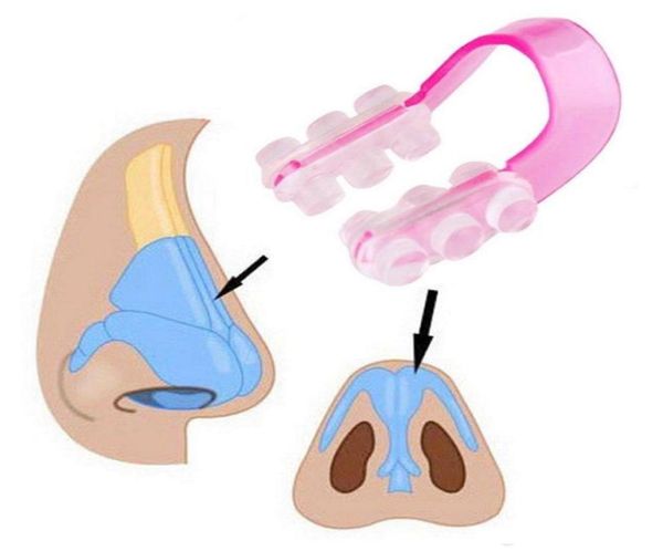 DHL Fashion Nose Up Shaping Shaper Pont de levage Redressage Beauté Pince-nez Visage Fitness Facial Clipper Correcteur Tool1337198